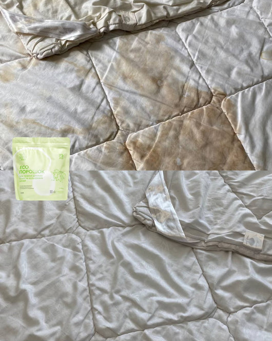 Main image for product index 16: Набір «без плям»